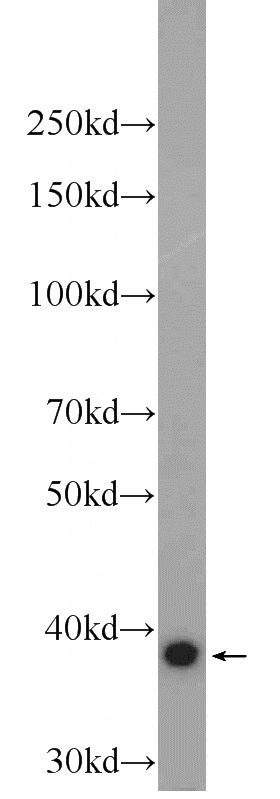 A431 cells were subjected to SDS PAGE followed by western blot with Catalog No:110513(FAM98C Antibody) at dilution of 1:300