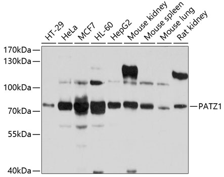 Western blot - PATZ1 Polyclonal Antibody 
