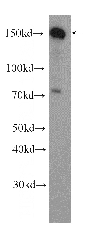 HeLa cells were subjected to SDS PAGE followed by western blot with Catalog No:116128(TIMELESS antibody) at dilution of 1:1000