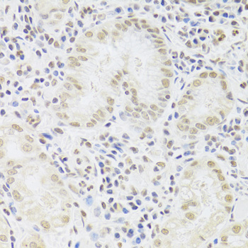 Immunohistochemistry - SNRPA Polyclonal Antibody 
