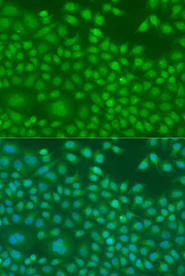 Immunofluorescence - NIN Polyclonal Antibody 
