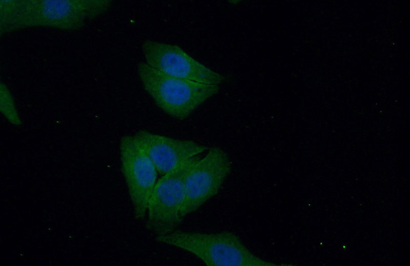 Immunofluorescent analysis of (10% Formaldehyde) fixed HepG2 cells using Catalog No:114361(PYGM-Specific Antibody) at dilution of 1:50 and Alexa Fluor 488-congugated AffiniPure Goat Anti-Rabbit IgG(H+L)