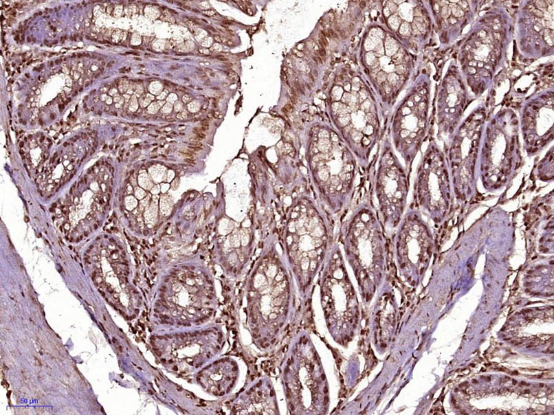 Fig2: Paraformaldehyde-fixed, paraffin embedded (Mouse colon); Antigen retrieval by boiling in sodium citrate buffer (pH6.0) for 15min; Block endogenous peroxidase by 3% hydrogen peroxide for 20 minutes; Blocking buffer (normal goat serum) at 37℃ for 30min; Antibody incubation with (SUPT16H) Polyclonal Antibody, Unconjugated at 1:400 overnight at 4℃, followed by operating according to SP Kit(Rabbit) (sp-0023) instructionsand DAB staining.