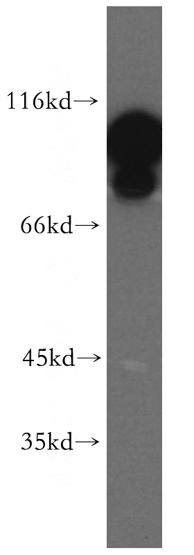 HeLa cells were subjected to SDS PAGE followed by western blot with Catalog No:110316(EEF2 antibody) at dilution of 1:500