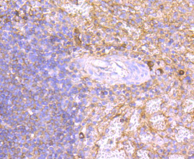Fig3:; Immunohistochemical analysis of paraffin-embedded human spleen tissue using anti-Human IgM antibody. The section was pre-treated using heat mediated antigen retrieval with Tris-EDTA buffer (pH 9.0) for 20 minutes.The tissues were blocked in 1% BSA for 30 minutes at room temperature, washed with ddH; 2; O and PBS, and then probed with the primary antibody ( 1/50) for 30 minutes at room temperature. The detection was performed using an HRP conjugated compact polymer system. DAB was used as the chromogen. Tissues were counterstained with hematoxylin and mounted with DPX.