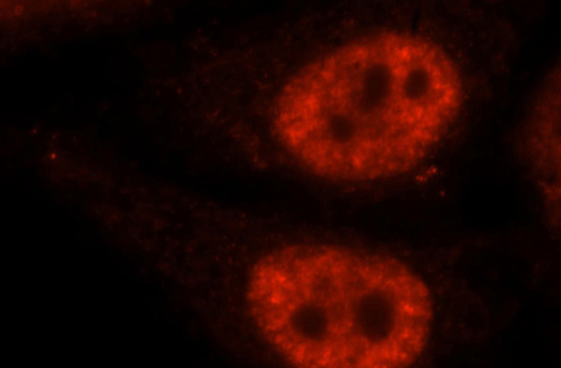 Immunofluorescent analysis of HepG2 cells, using SF3A1 antibody Catalog No:115133 at 1:25 dilution and Rhodamine-labeled goat anti-rabbit IgG (red).