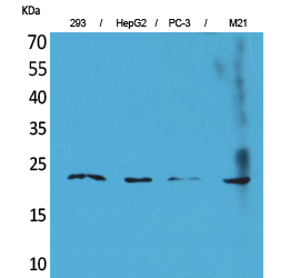 Fig1:; Western Blot analysis of 293, HepG2, PC-3, M21 cells using FGF-6 Polyclonal Antibody.. Secondary antibody（catalog#: HA1001) was diluted at 1:20000