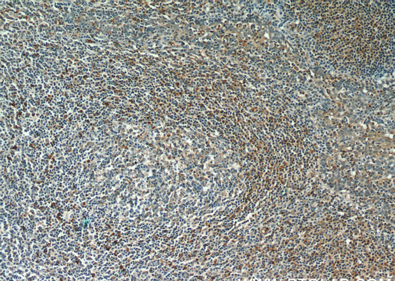 Immunohistochemistry of paraffin-embedded human tonsillitis tissue slide using Catalog No:111859(Integrin alpha-4 Antibody) at dilution of 1:50