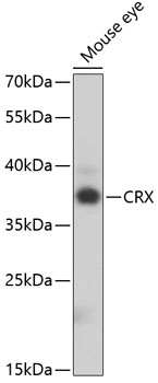 Western blot - CRX Polyclonal Antibody 