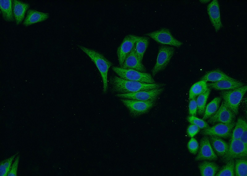 Immunofluorescent analysis of HepG2 cells using Catalog No:114756(RNF26 Antibody) at dilution of 1:50 and Alexa Fluor 488-congugated AffiniPure Goat Anti-Rabbit IgG(H+L)