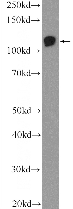 rat testis tissue were subjected to SDS PAGE followed by western blot with Catalog No:110383(EPHB4 Antibody) at dilution of 1:1000