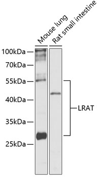 Western blot - LRAT Polyclonal Antibody 