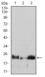 Western blot analysis using HPRT1 mouse mAb against Hela (1), A431 (2), A549 (3) cell lysate.