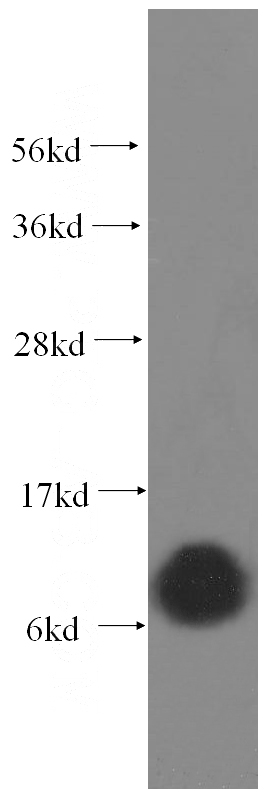 human brain tissue were subjected to SDS PAGE followed by western blot with Catalog No:109493(COX6A1 antibody) at dilution of 1:500
