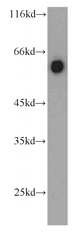 HEK-293 cells were subjected to SDS PAGE followed by western blot with Catalog No:114287(PSAP antibody) at dilution of 1:300