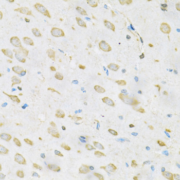 Immunohistochemistry - TRIM29 Polyclonal Antibody 