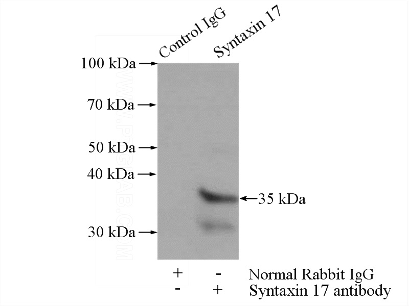IP Result of anti-STX17 (IP:Catalog No:115794, 4ug; Detection:Catalog No:115794 1:1000) with HepG2 cells lysate 3600ug.