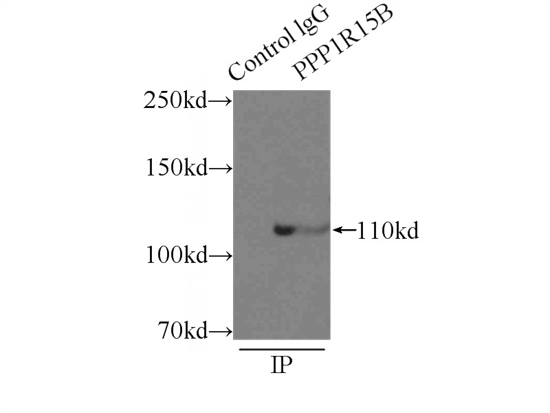 IP Result of anti-PPP1R15B;CReP (IP:Catalog No:114153, 3ug; Detection:Catalog No:114153 1:1000) with MCF-7 cells lysate 2500ug.