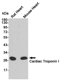 Western blot analysis of extracts from Rat and mouse heart tissue using Troponin I (168382,dilution 1:1000) Mouse mAb.Predicted band size:28kDa.Observed band size:28kDa.