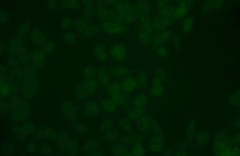 Immunofluorescent analysis of MCF-7 cells using Catalog No:116604(USP3 Antibody) at dilution of 1:25 and Alexa Fluor 488-congugated AffiniPure Goat Anti-Rabbit IgG(H+L)