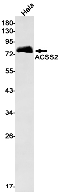 Western blot detection of ACSS2 in Hela cell lysates using ACSS2 Rabbit mAb(1:1000 diluted).Predicted band size:79kDa.Observed band size:79kDa.