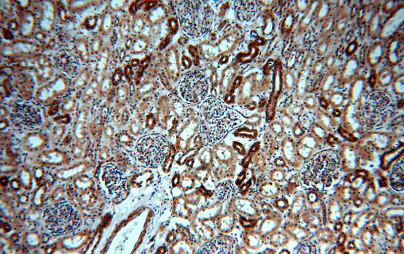 Immunohistochemical of paraffin-embedded human kidney using Catalog No:107780(ADCY3 antibody) at dilution of 1:100 (under 10x lens)