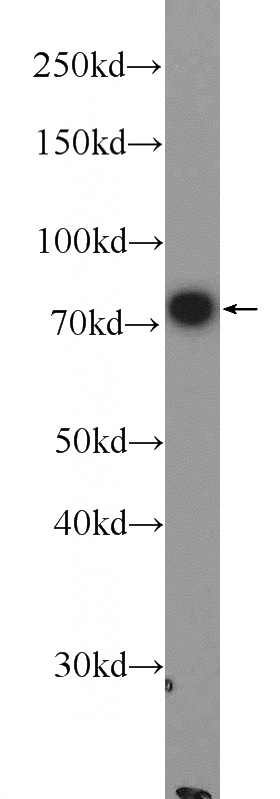 HeLa cells were subjected to SDS PAGE followed by western blot with Catalog No:111037(GLT25D1 Antibody) at dilution of 1:1000