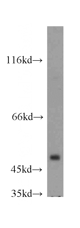 Jurkat cells were subjected to SDS PAGE followed by western blot with Catalog No:110806(GABPB2 antibody) at dilution of 1:500