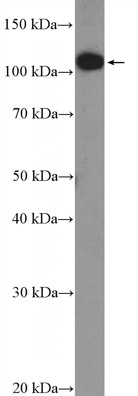 SKOV-3 cells were subjected to SDS PAGE followed by western blot with Catalog No:109888(DENND1A Antibody) at dilution of 1:600