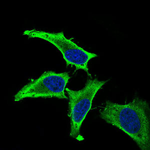 Immunofluorescence analysis of Hela cells using MEF2A mouse mAb (green). Blue