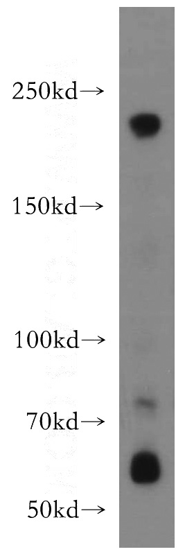 mouse brain tissue were subjected to SDS PAGE followed by western blot with Catalog No:113131(NAV1 antibody) at dilution of 1:500