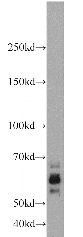 human brain tissue were subjected to SDS PAGE followed by western blot with Catalog No:110566(FBXW7 antibody) at dilution of 1:600