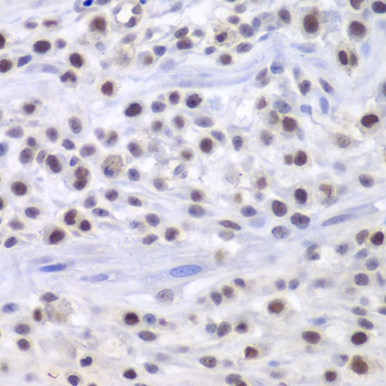 Immunohistochemistry - HAT1 Polyclonal Antibody 