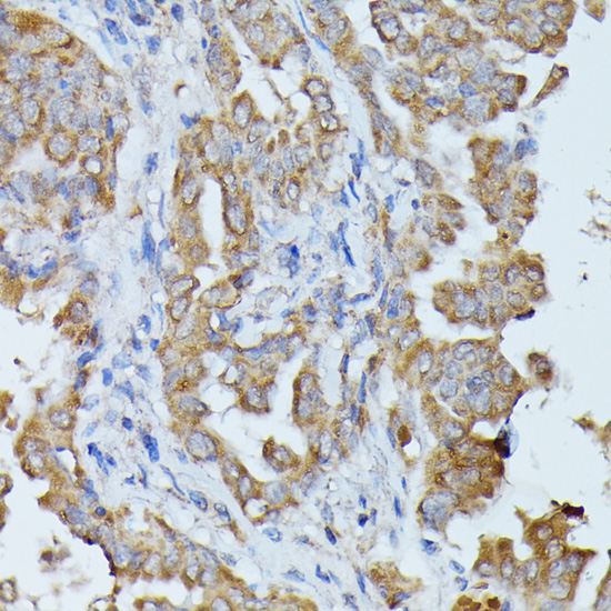 Immunohistochemistry - HAL Polyclonal Antibody 