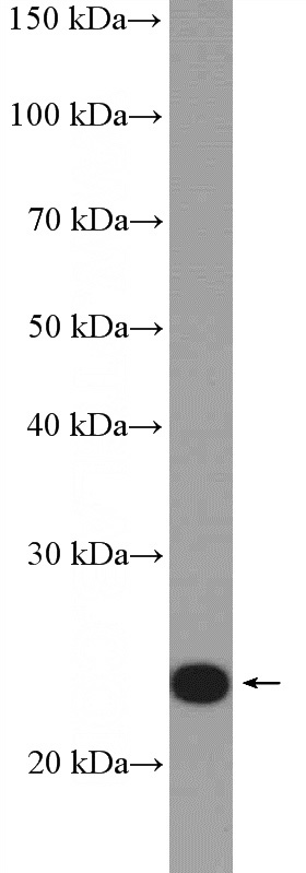 mouse brain tissue were subjected to SDS PAGE followed by western blot with Catalog No:114529(RALA Antibody) at dilution of 1:1000