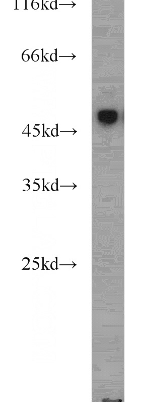 mouse pancreas tissue were subjected to SDS PAGE followed by western blot with Catalog No:116496(NPR2L,TUSC4 antibody) at dilution of 1:1000