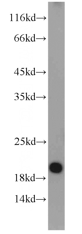 HEK-293 cells were subjected to SDS PAGE followed by western blot with Catalog No:115837(SUMO2/3 antibody) at dilution of 1:1000