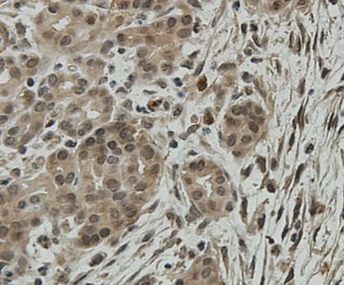 Fig9: Immunohistochemical analysis of paraffin-embedded human pancreas tissue using anti-CCDC51 antibody. Counter stained with hematoxylin.