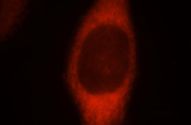 Immunofluorescent analysis of MCF-7 cells, using FARSA antibody Catalog No:110525 at 1:25 dilution and Rhodamine-labeled goat anti-rabbit IgG (red).