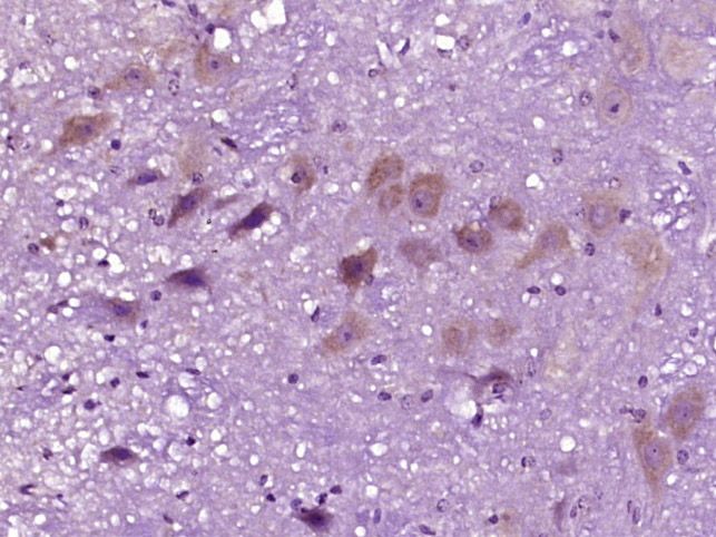Fig4: Paraformaldehyde-fixed, paraffin embedded (mouse brain tissue); Antigen retrieval by boiling in sodium citrate buffer (pH6.0) for 15min; Block endogenous peroxidase by 3% hydrogen peroxide for 20 minutes; Blocking buffer (normal goat serum) at 37℃ for 30min; Antibody incubation with (Gamma-Adaptin) Polyclonal Antibody, Unconjugated at 1:400 overnight at 4℃, followed by operating according to SP Kit(Rabbit) (sp-0023) instructionsand DAB staining.