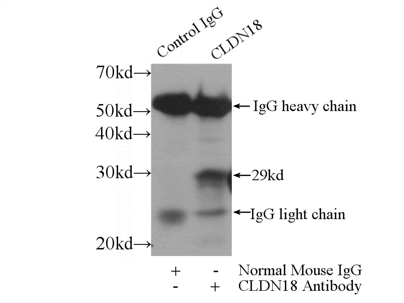 IP Result of anti-CLDN18 (IP:Catalog No:107159, 3ug; Detection:Catalog No:107159 1:300) with mouse stomach tissue lysate 4000ug.