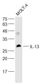 Fig3: Sample:; Molt-4(Human) Cell Lysate at 30 ug; Primary: Anti-IL-13 at 1/500 dilution; Secondary: IRDye800CW Goat Anti-Rabbit IgG at 1/20000 dilution; Predicted band size: 12 kD; Observed band size: 32 kD