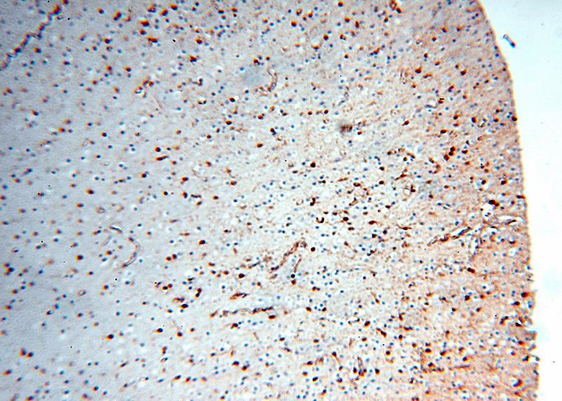 Immunohistochemical of paraffin-embedded human brain using Catalog No:112762(MT3 antibody) at dilution of 1:50 (under 10x lens)