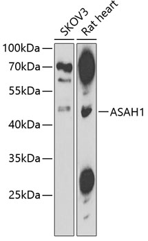 Western blot - ASAH1 Polyclonal Antibody 