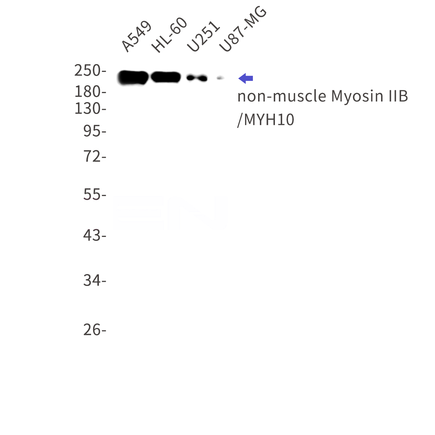 Western blot detection of non-muscle Myosin IIB/MYH10 in A549,HL-60,U251,U87-MG cell lysates using non-muscle Myosin IIB/MYH10 Rabbit mAb(1:1000 diluted).Predicted band size:229kDa.Observed band size:229kDa.