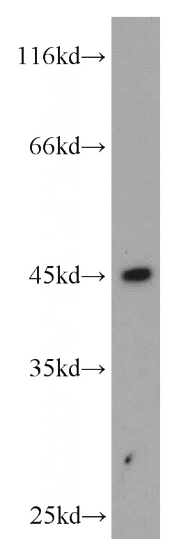 human placenta tissue were subjected to SDS PAGE followed by western blot with Catalog No:111430(HLA-F antibody) at dilution of 1:500