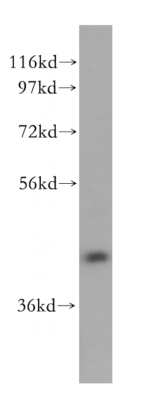 human brain tissue were subjected to SDS PAGE followed by western blot with Catalog No:114447(RAB3IL1 antibody) at dilution of 1:500