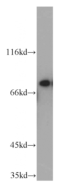 human brain tissue were subjected to SDS PAGE followed by western blot with Catalog No:113730(PEX5 antibody) at dilution of 1:500