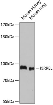 Western blot - KIRREL Polyclonal Antibody 