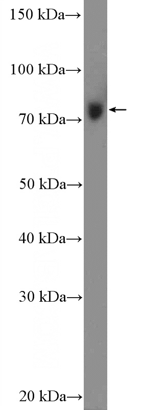 HEK-293 cells were subjected to SDS PAGE followed by western blot with Catalog No:112209(DHX58 Antibody) at dilution of 1:300